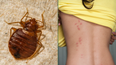 All you need to know about bedbugs if you’re Paris bound this weekend
